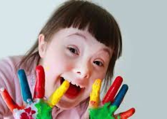 Fresco Charity Fund celebrated The World Down Syndrome Day.